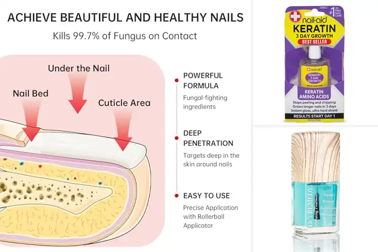 Detailed view of Best Thickened Nail Remedies